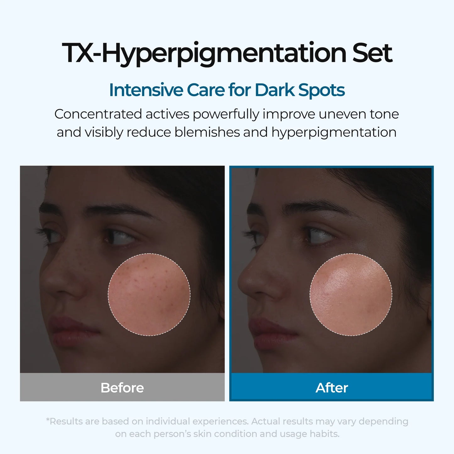 Dark Spot & Uneven Tone Peel Shot TX Duo